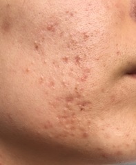 To ask if there is anything I could do with my skin (photo)