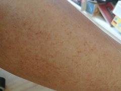 Can anyone tell me what's going on with my legs please? Photos included.