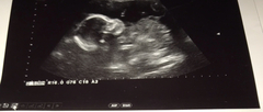 Boy or girl