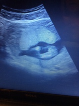 Gender scan 15 weeks, sonogrpaher said it was girl but I thought boy, please see