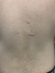 Anyone got any ideas what these marks are