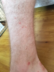 What is this on DP's legs?