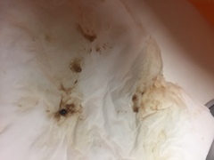 TMI (with pics) FTM mucus plug question...