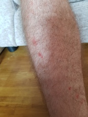 What is this on DP's legs?