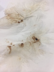 TMI (with pics) FTM mucus plug question...