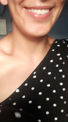 Sooo, who’s tried lip fillers?!