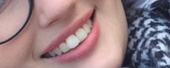 Sooo, who’s tried lip fillers?!