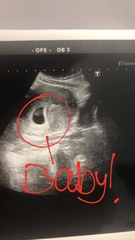 What can I expect to see on a scan at seven weeks?