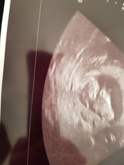 Male or Female - just for fun **Title edited by MNHQ**