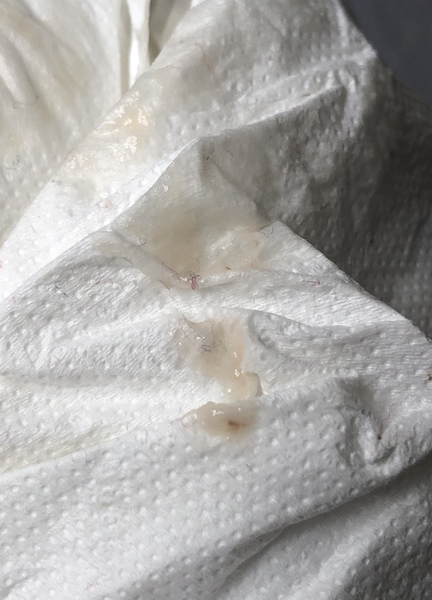 Could this be implantation bleed? *warning - picture attached*