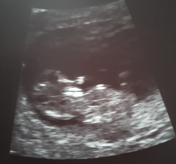 The March-ers 2019 #4