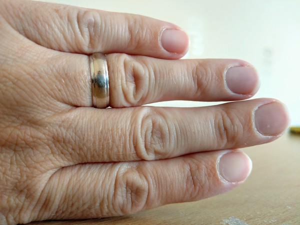 Wedding ring dilema show me yours