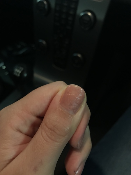 Help! Can I rescue this smudged nail?!