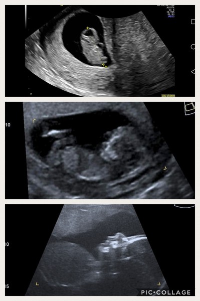 First Pregnancies with Nov/Dec Due dates :)