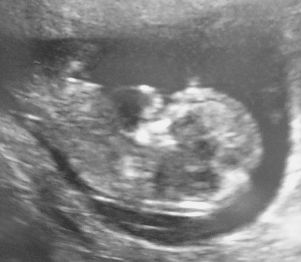 The March-ers 2019 #4