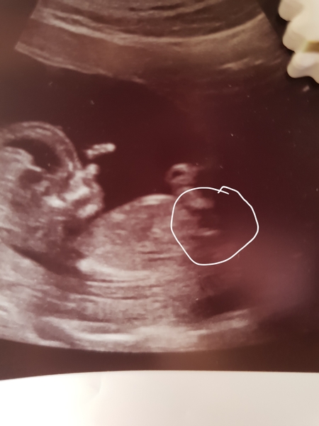 What's this? Pic included!