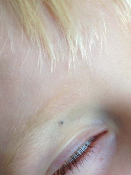 What's this on DS's eye??