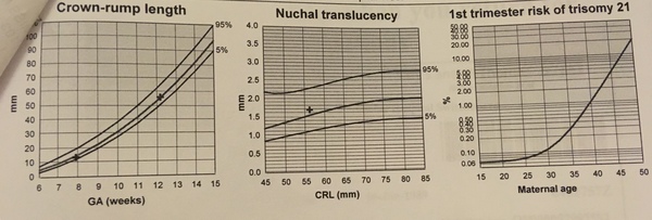 Feb 2019 Thread 5: 12 week scans and the start of the second trimester.
