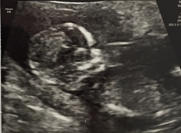 Gender prediction... GO!