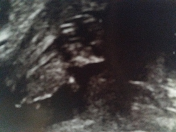 Whose up for a bit of fun??? Boy or girl?