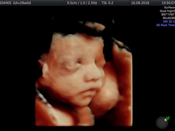First Pregnancies with Nov/Dec Due dates :)
