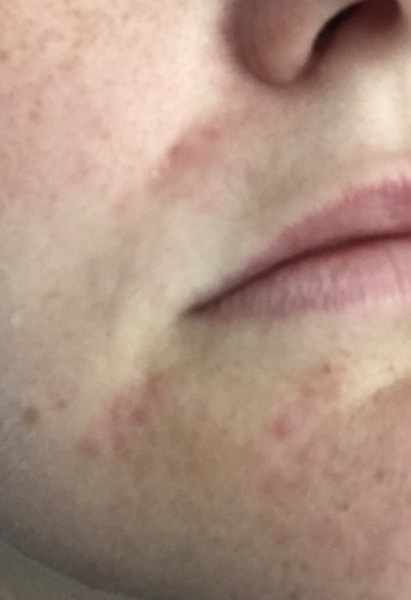 Help! Bad skin!