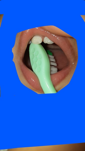 DDs teeth pic