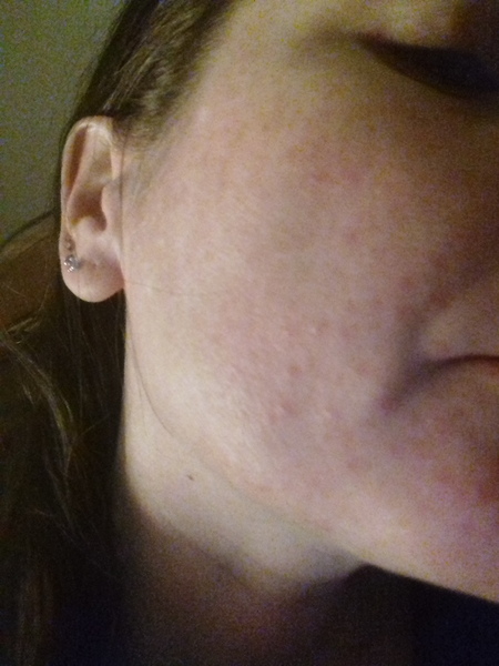 To ask for help with my skin