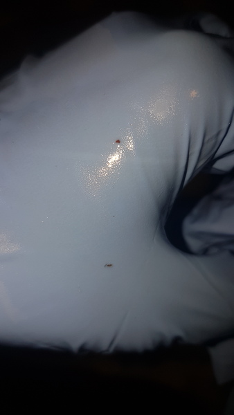 Nits/headlice