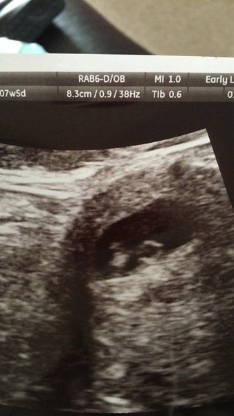 Pregnancy after loss: spring 2019 edition (The Brexit Babes) 🐧