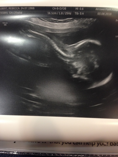 More Christmas Cake! Pregnancy after loss (thread 3)