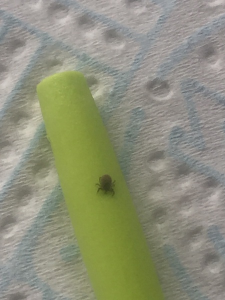 4 year old, tick bite/Lyme symptoms