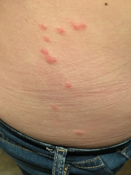 To think we can leave bed bugs here