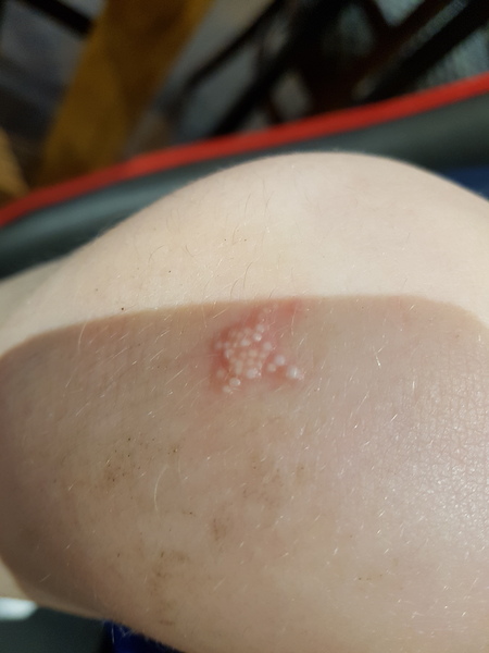 What is this? (Gross alert) Pic attached.