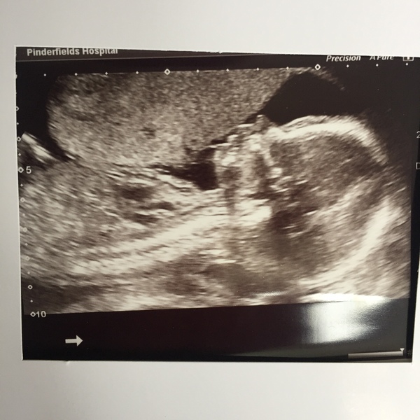 December 2018 Babies - Thread #4