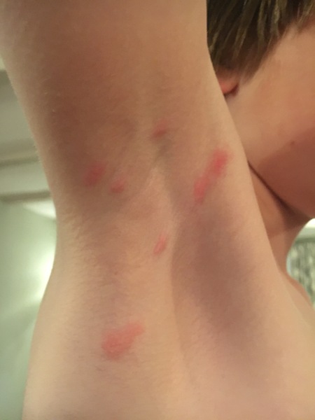 What are these spots? (Photo)