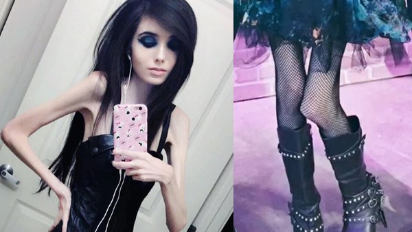 To not understand how this different from putting an anorexic model on the cover