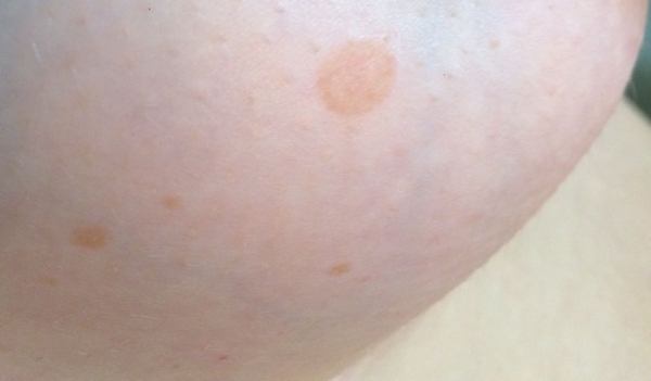 Anyone know what this looks like?
