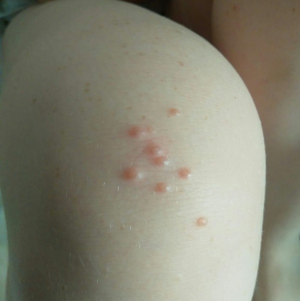 What's on DD's knee? Diagnosis please (photo included)