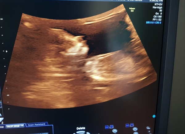 Girl or boy?