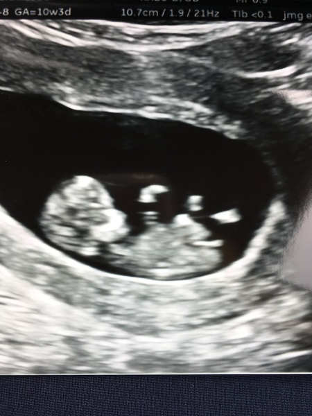 The March-ers (2019) #3