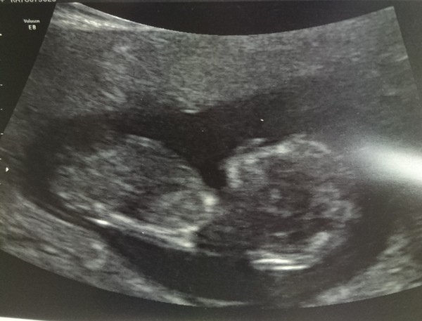 The March-ers 2019 #4