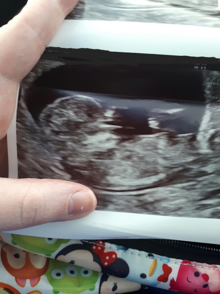 Feb 2019 Thread 5: 12 week scans and the start of the second trimester.