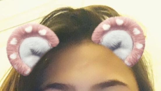 To ask about scarring after huge cut? Have you dcs had scars?