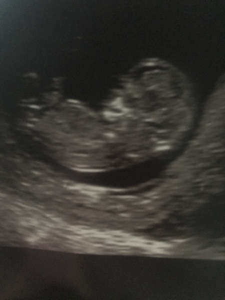 Nub Theory - we really don't care if it's a boy or a girl, but anyone want to guess?