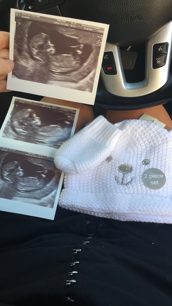 Feb 2019 Thread 5: 12 week scans and the start of the second trimester.