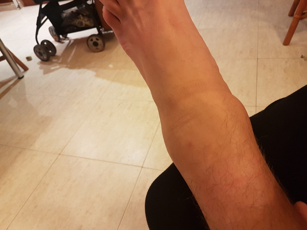 anyone have experience of Spanish hospitals?