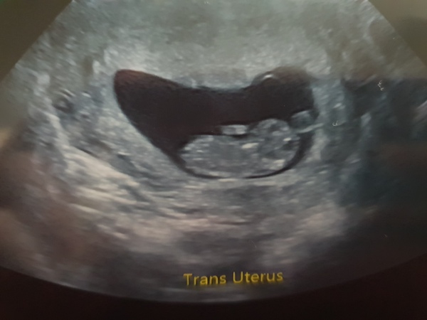 The March-ers 2019 #4