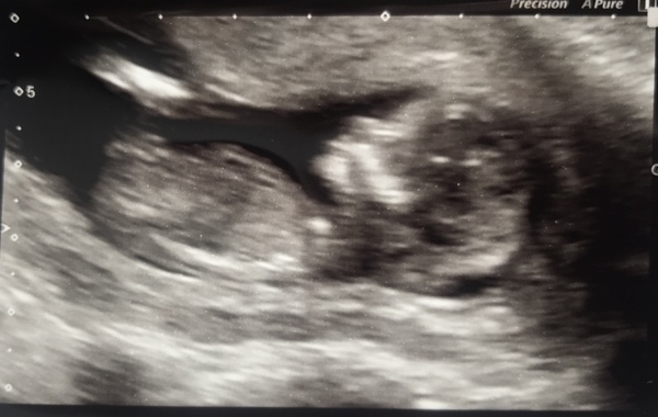 The March-ers 2019 #4