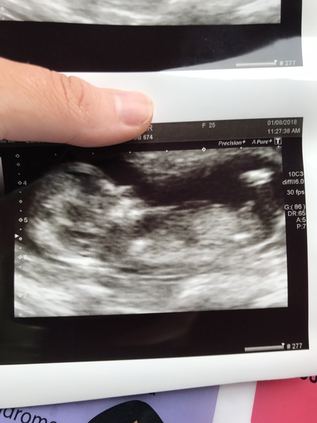 Boy or Girl??